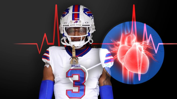What Happened to Damar Hamlin